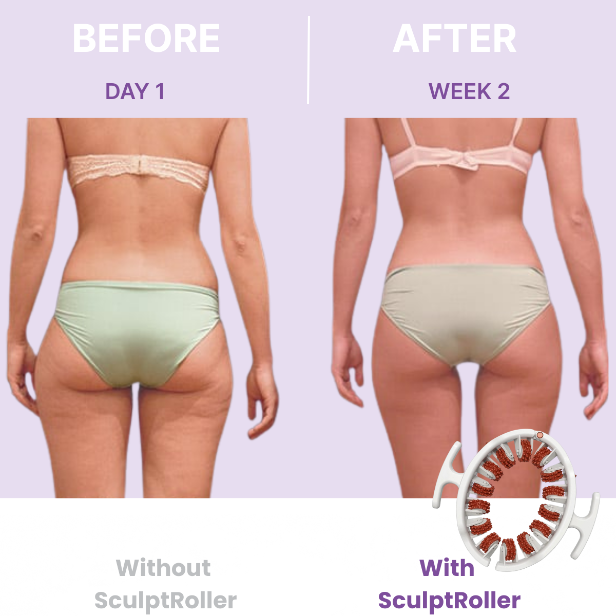 TREVIA™ SculptRoller